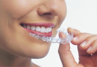 Dra-Cristina-saiba-as-vantagens-do-invisalign-e-onde-encontrar-em-quirinopolis
