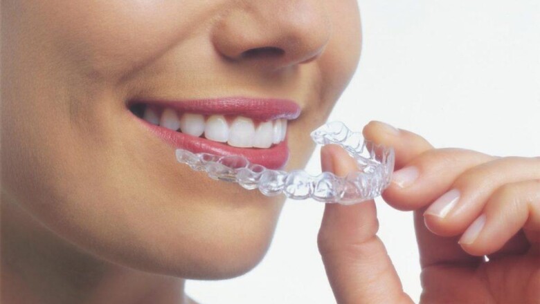 Invisalign: O aparelho dental invisível